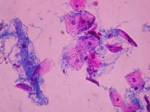 sq_epi_11