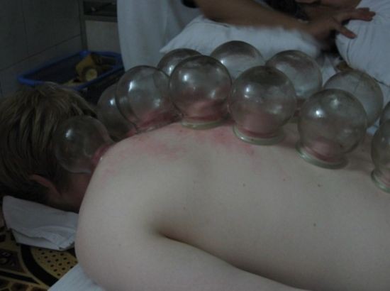 cinska medicina